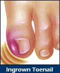 COMMON NAIL PROBLEMS.gif